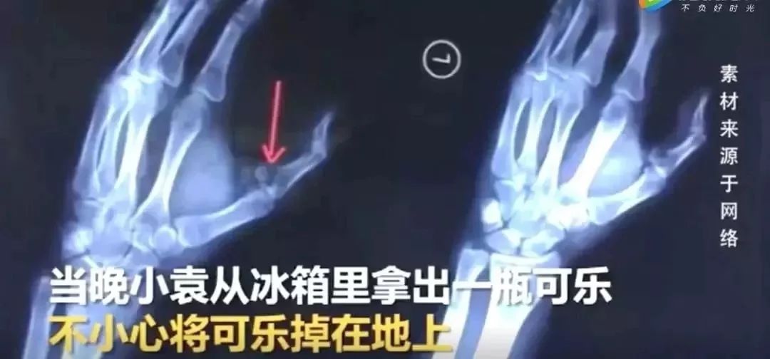                     因为一罐冰可乐，6岁男孩被缝38针！这件危险事很多厦门人还不以为然...