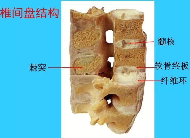 椎间盘:1,软骨终板(endplat of cartilage) 2,纤维环 3,髓核