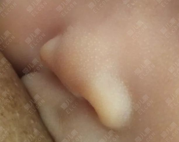                     宝宝睡觉突然抖一下，是生病了还是吓着了？