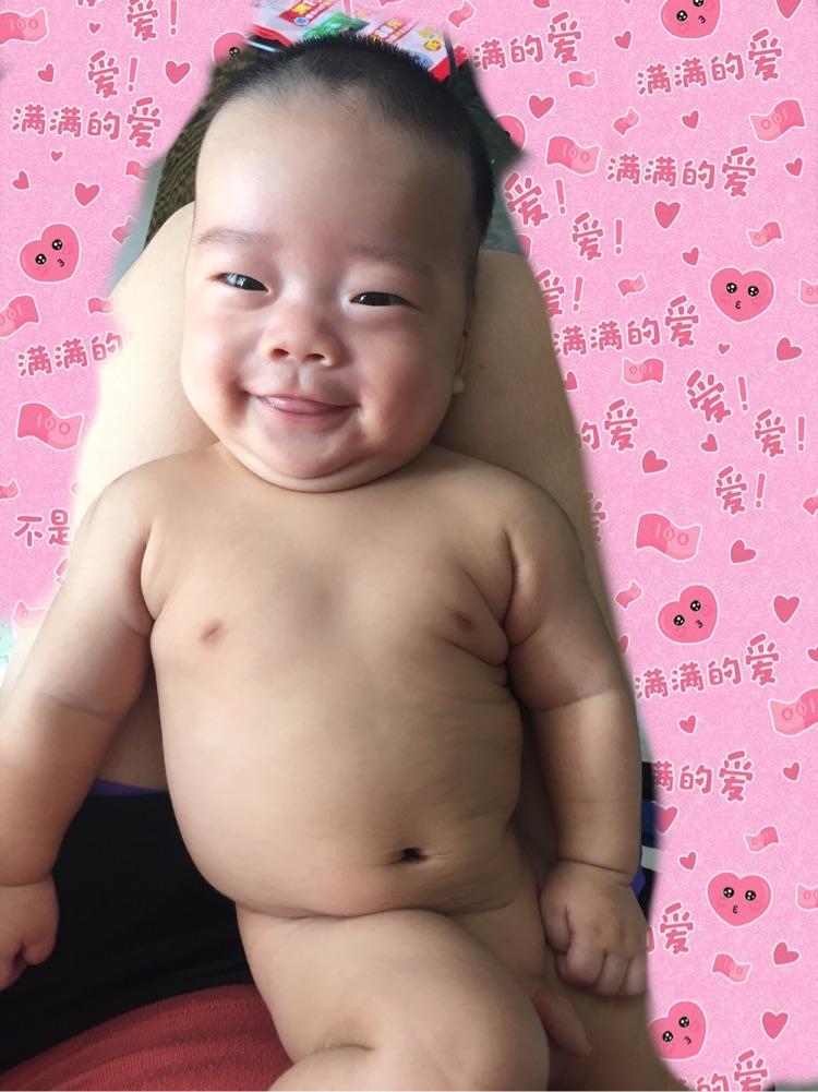                     原创            早产宝宝四个半月肌张力高，脖子后仰，斜视，拇指内扣