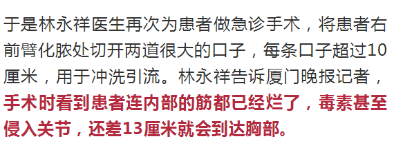 福建一男子洗虾被刺到，9天后肝脏衰竭，差点没命！