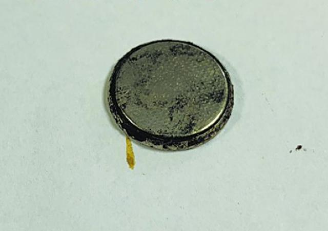                     原创            一岁宝宝误吞纽扣电池，送急诊后食管已感染，这张照片值得反省