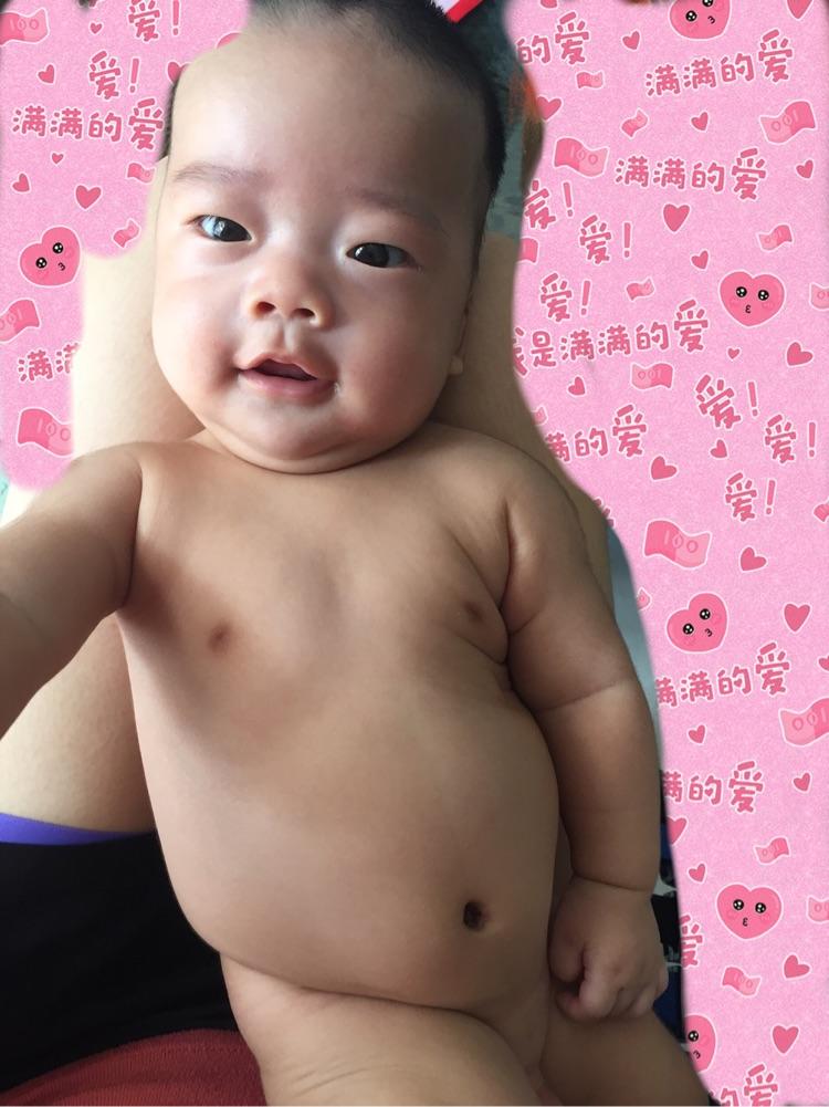                     原创            早产宝宝四个半月肌张力高，脖子后仰，斜视，拇指内扣