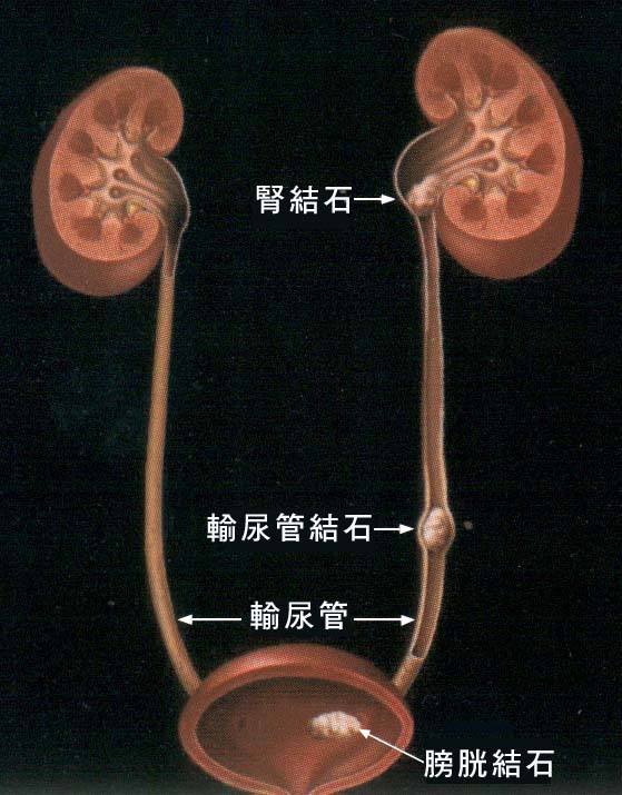 右腰疼怎么办