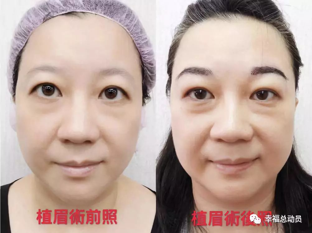 如何快速变美五官 6a32f23657ef49c8af118a6af71f4dc5.jpeg