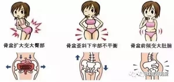 产后修复是选择骨盆修复还是盆底肌修复