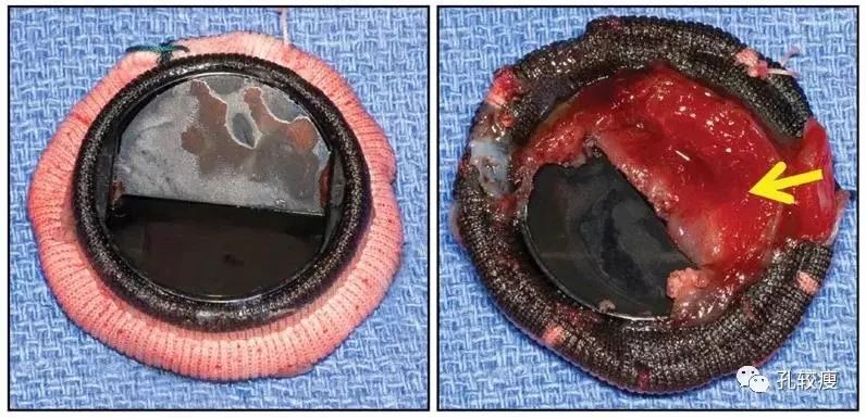 83054e378a64470d92c8fe9e10bc4907.jpeg