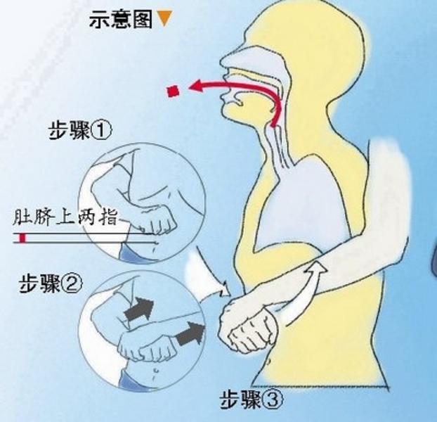                     原创            一岁宝宝误吞纽扣电池，送急诊后食管已感染，这张照片值得反省