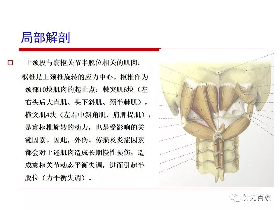 寰枢关节错位该怎么办