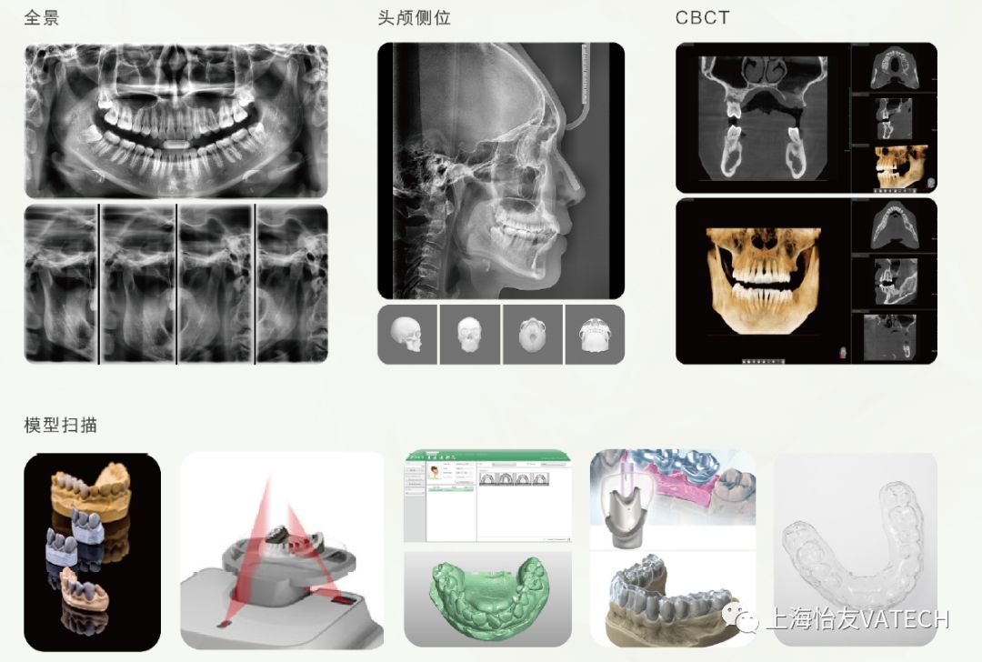 分别为全景,头颅侧位,cbct和模型扫描.