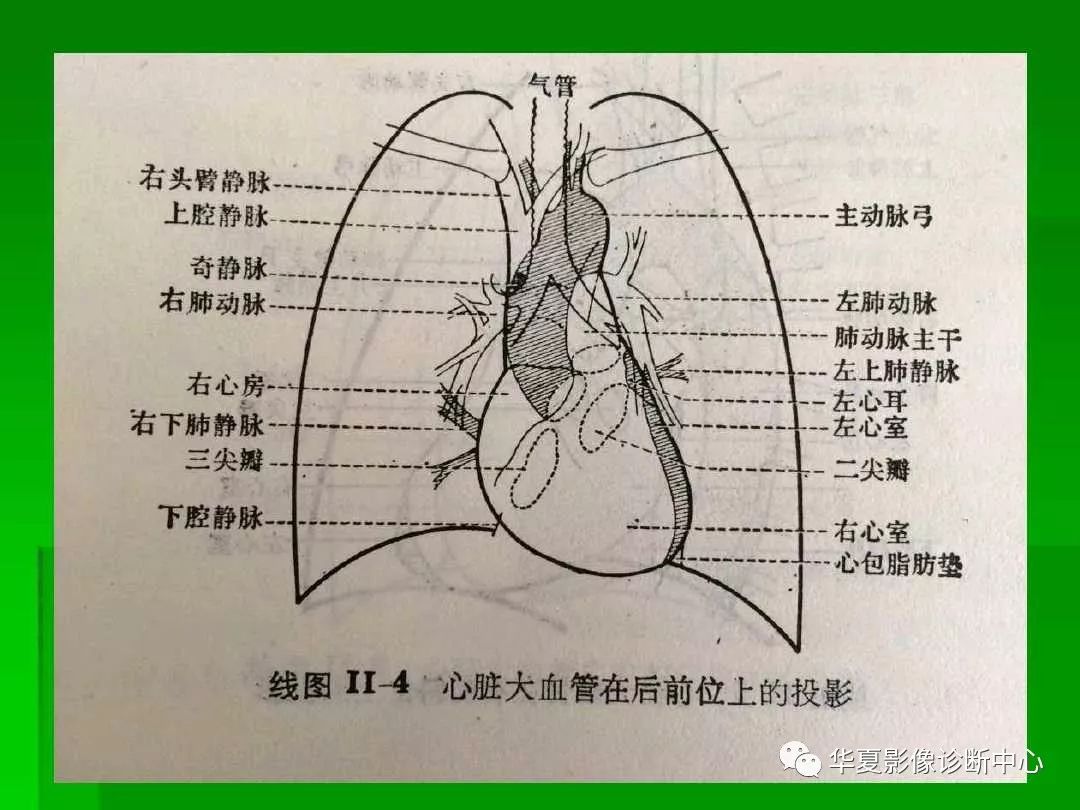 246.心脏的外形和血管 (后面观)-系统解剖学-医学