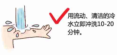                     原创            宝宝烫伤后该怎么办？涂牙膏、香油不可取，正确做法记牢5个字