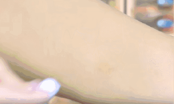 吃什么东西可以缓解皮肤干燥 1b4041152e214d9ba7ba8847d77560ef.gif