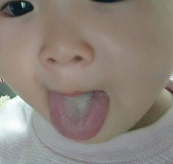                     孩子咳嗽半月，不会是积食性咳嗽吧？1个苹果和它煮！百试百灵