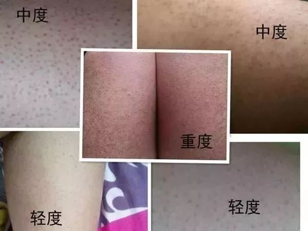 4d90f469aee64d24a8638e6f3e4d3c4e.jpeg