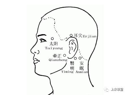 按压方法:单耳选取3-5个穴位,每贴按压钟,按压程度为痛为适宜