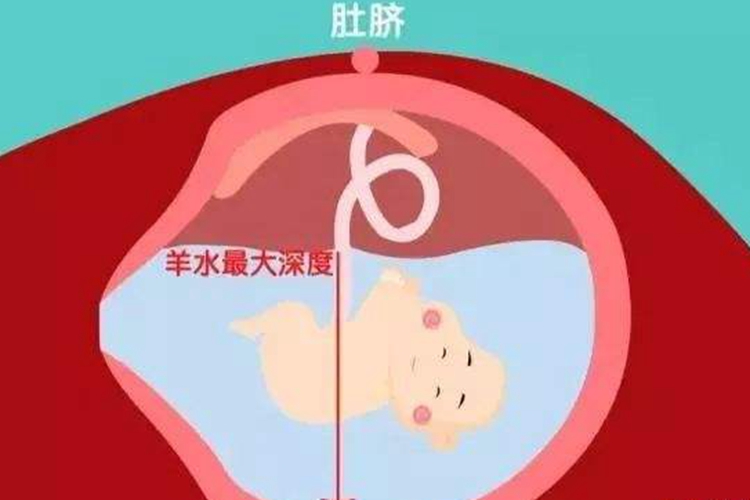 孕晚期检测不到"胎心",很可能是这两个原因引起,孕妈要早早注意了