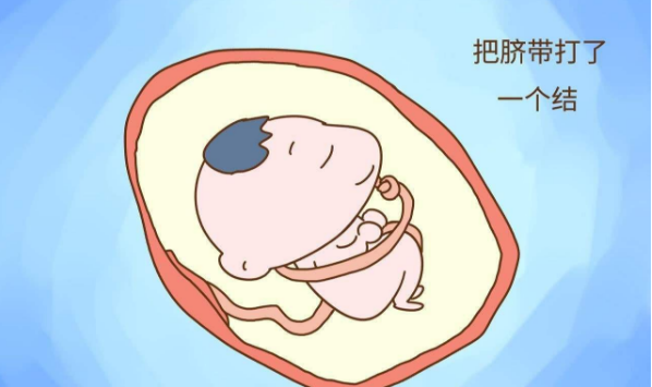                     胎儿为什么会出现脐带绕颈？怎样避免胎儿脐带绕颈？