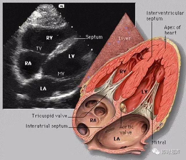心脏超声图片与断层解剖对照图