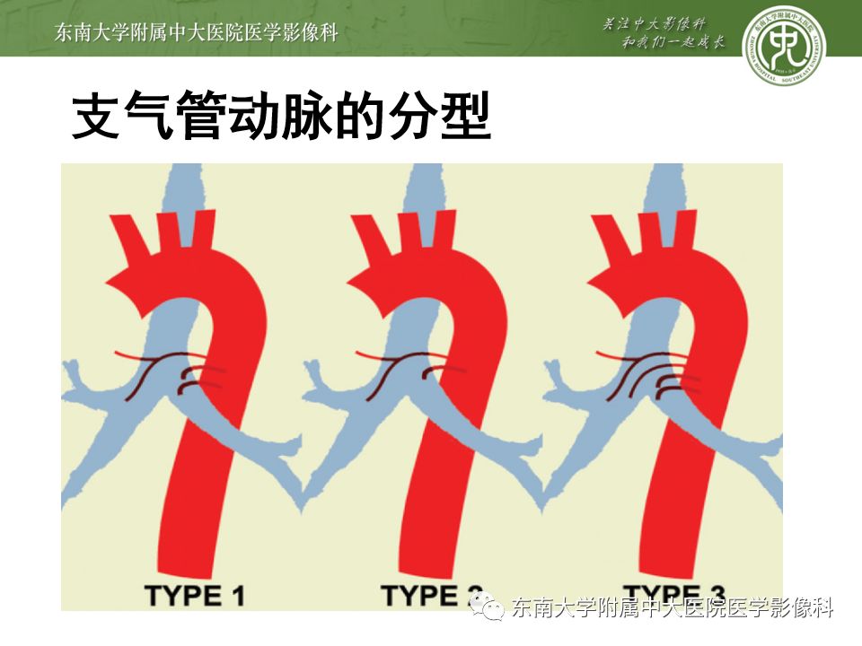 支气管动脉解剖及异常影像表现