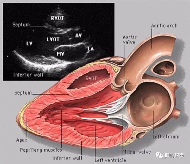 心脏超声图片与断层解剖对照图
