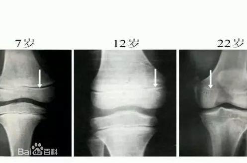                     4岁女儿“性早熟”！这4件事家长要注意了，别让孩子过早发育
