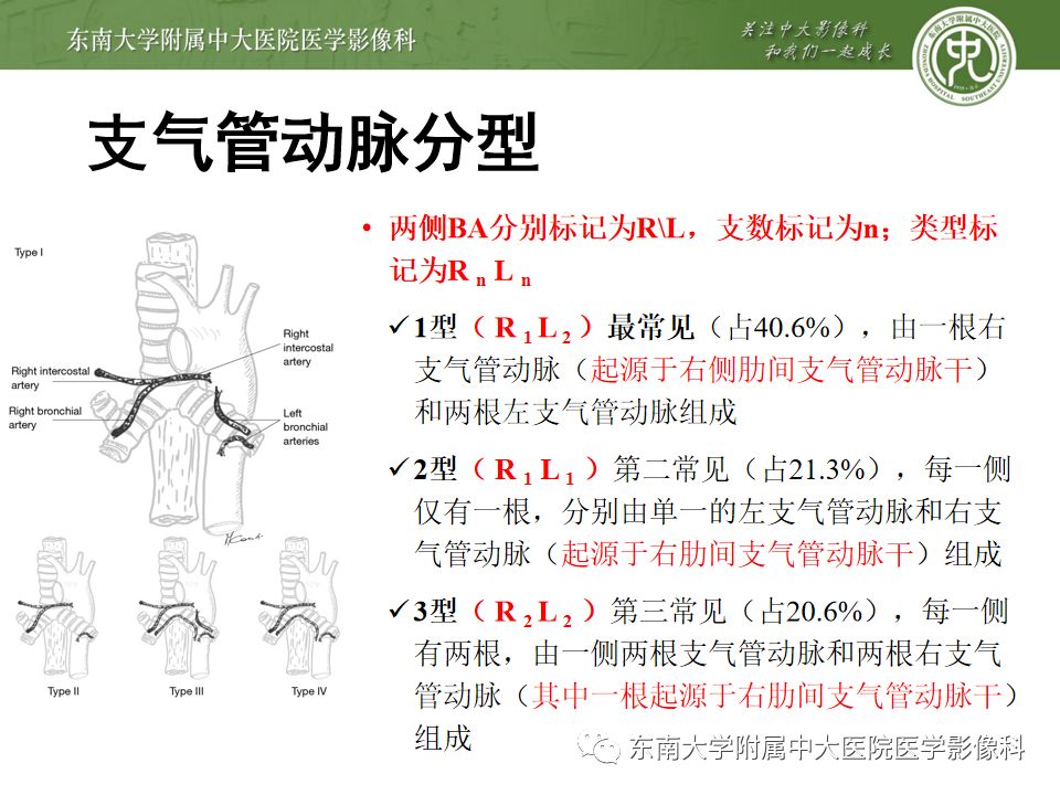 支气管动脉解剖及异常影像表现