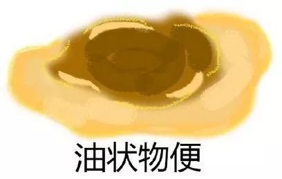                     宝宝大便的“7形11状”，你一定要了解