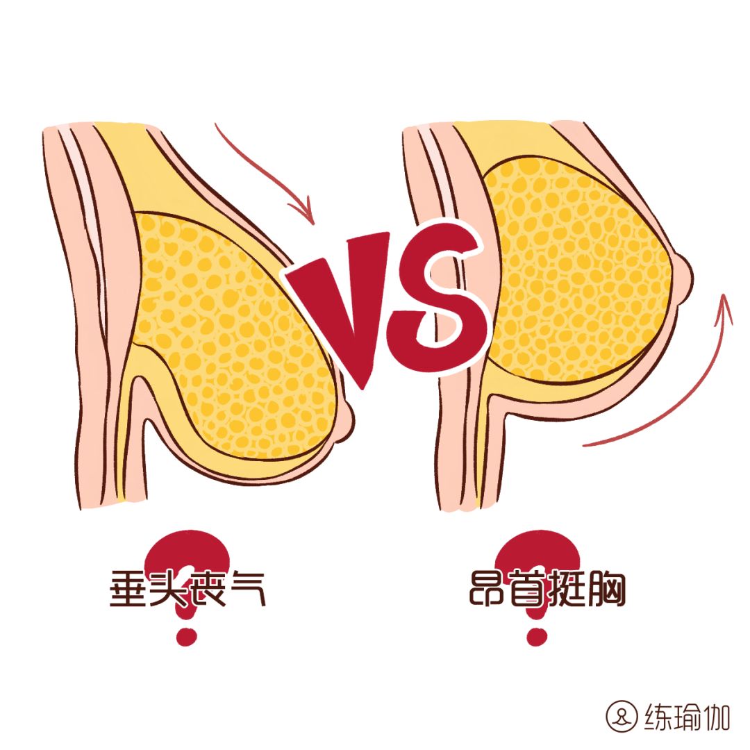 乳房下垂自测：女性从20岁起出现中度下垂…… - 知乎