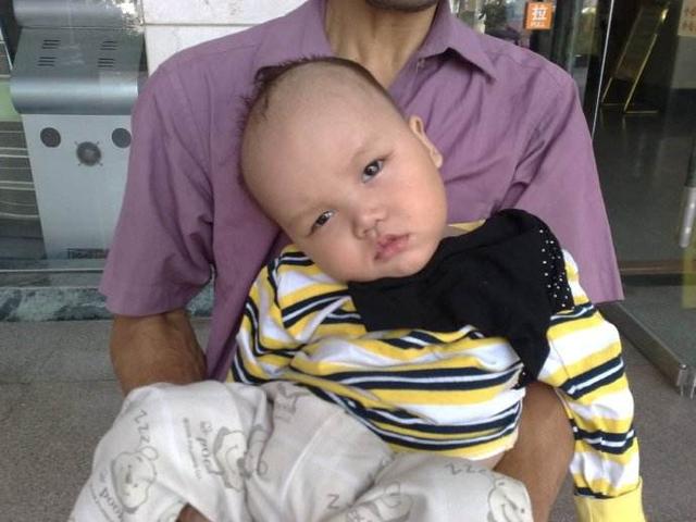                     孩子缺锌危害比缺铁更严重，缺锌有这5个症状，补锌用3个方法