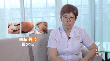                     原创            新生儿蜕皮到底是不是病？