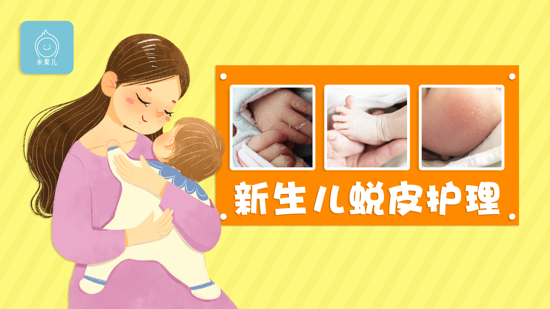                     原创            新生儿蜕皮到底是不是病？