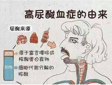 痛风高尿酸血症可不可以吃酸的食物别乱猜这里告诉你答案