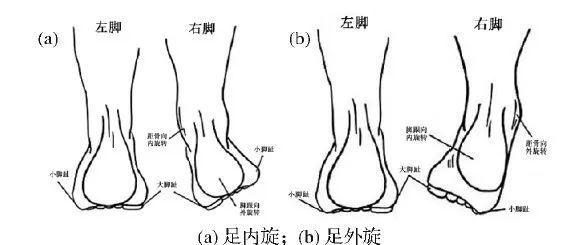 跑步者选择跑步鞋时,还要结合足弓类型和足翻转类型选择不同跑鞋