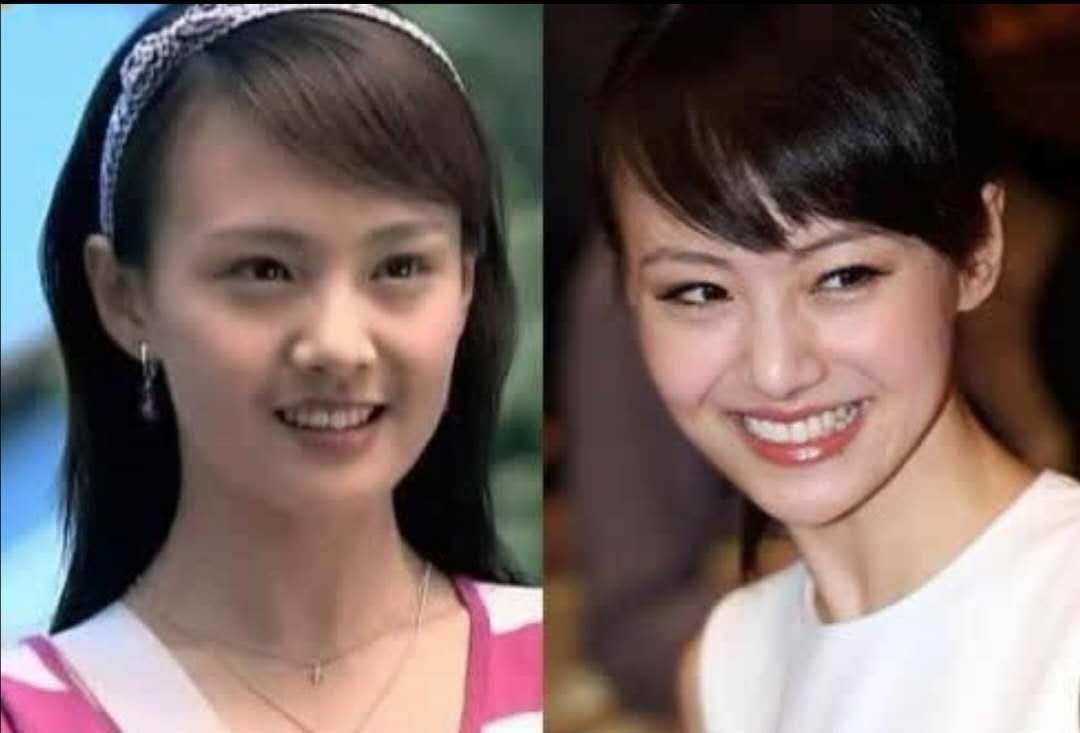 郑爽回怼秀恩爱脱粉事件;龄近30少女感十足,鼻子太奇怪