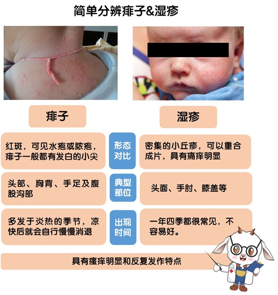 宝妈最容易误判的皮肤红疹!小心越护理越严重!