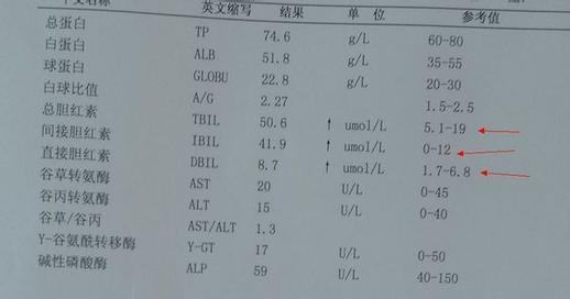 原创肝功能各项正常范围是多少,黄疸和肝脏受损,能否直接发现?