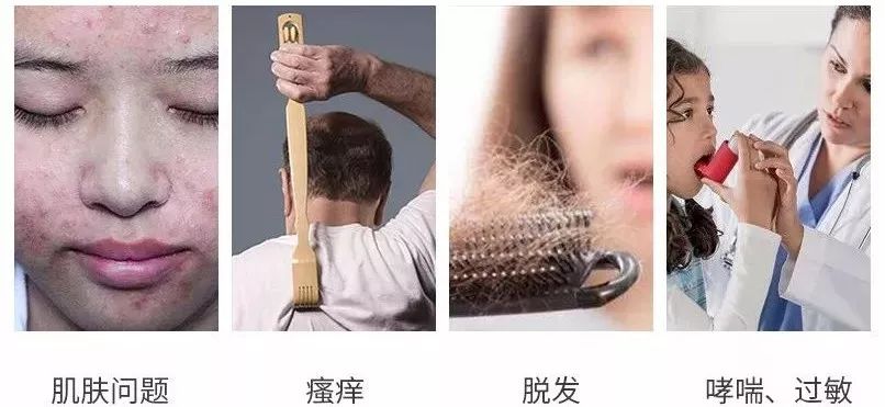 如何检查自己有没有螨虫 11eddeb7823f486596ac02f8cbbf2bb7.jpeg