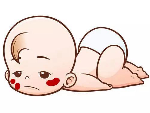 口服普萘洛尔治疗婴幼儿血管瘤