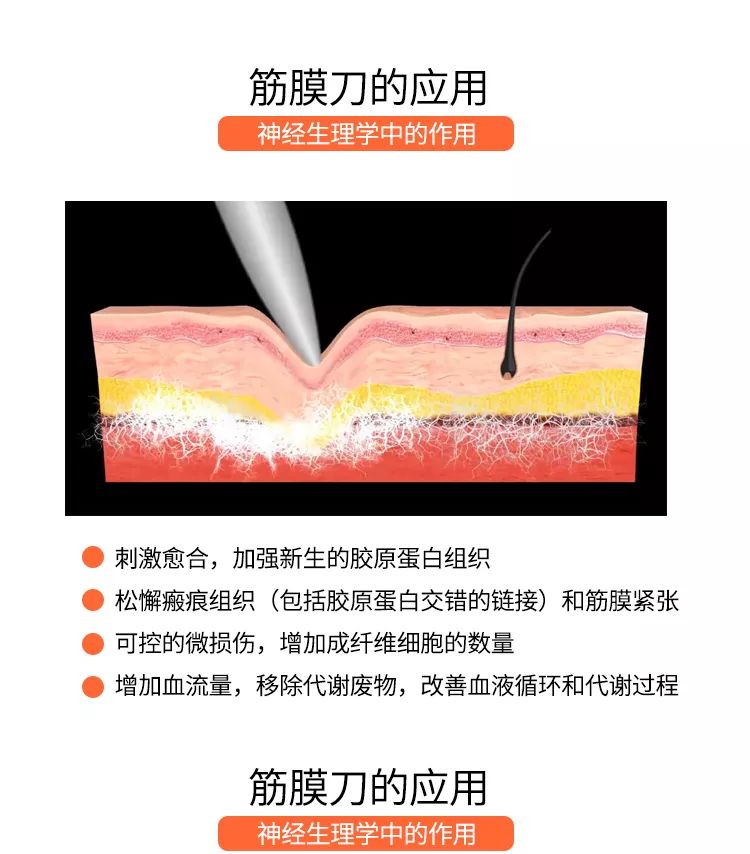 iastm筋膜刀松解刀软组织康复松解放松刮痧放松刀