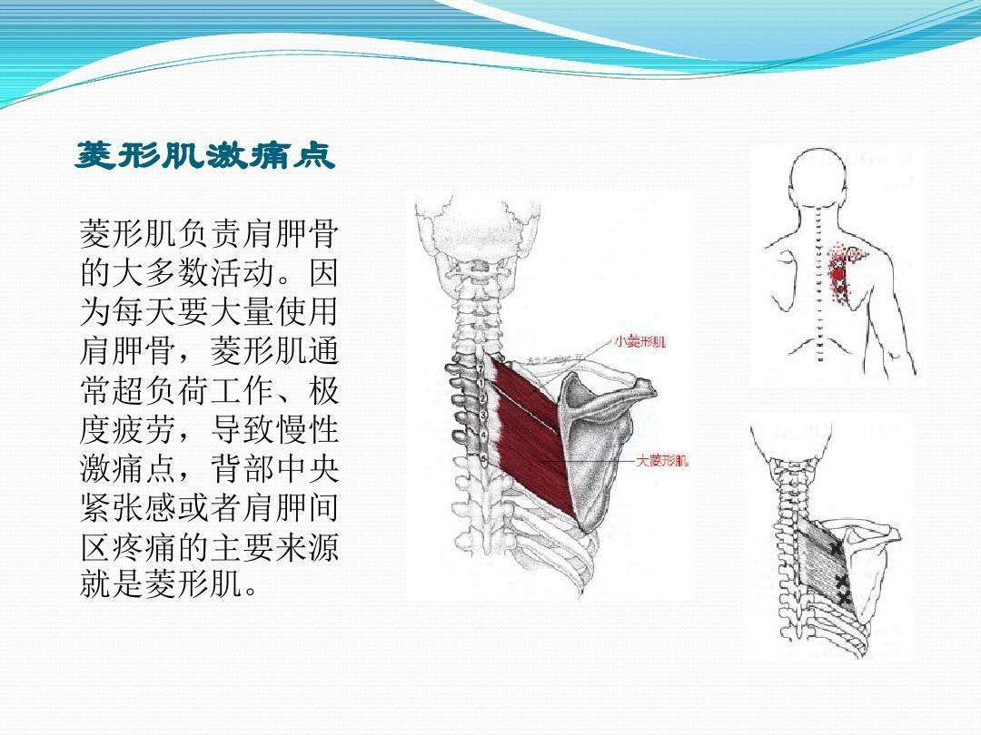 疼痛科有一种伤不起的痛叫肌筋膜炎