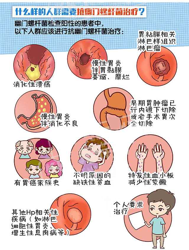 感染了幽门螺旋杆菌怎么办别担心有维优安帮你