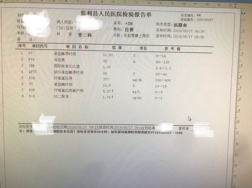 再谈凝血几类特殊人群的凝血功能解析