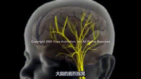                      千万别用这个动作哄宝宝睡觉，已有8成患儿终身残疾！