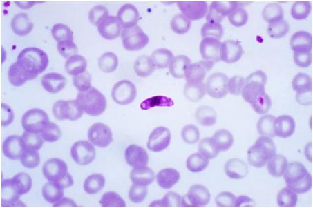 恶性疟原虫 plasmodium falciparum. 图片来自网络.