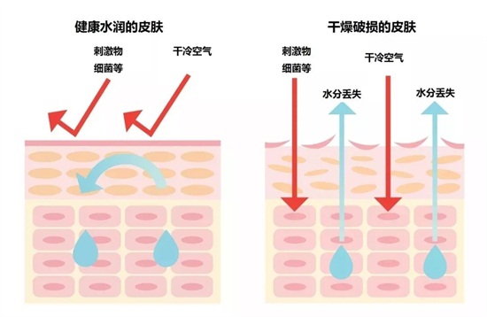 皮肤干燥起疹子图片