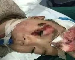                     玩具还是玩命？又一款危险玩具被列入黑名单！