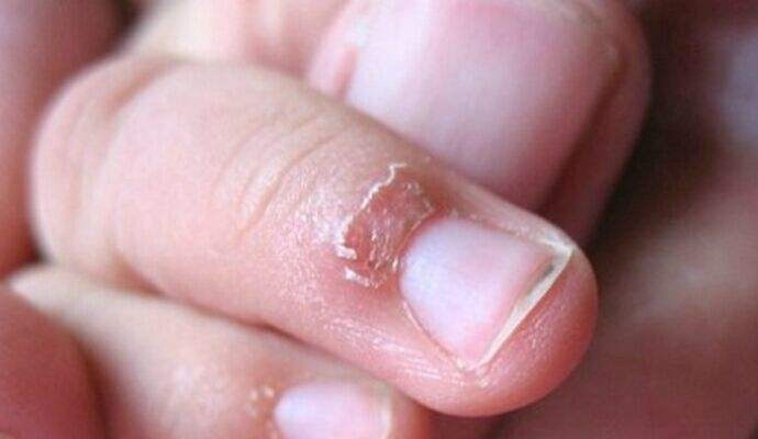                     宝宝什么情况才算缺锌严重？这些补锌食物一样少不了