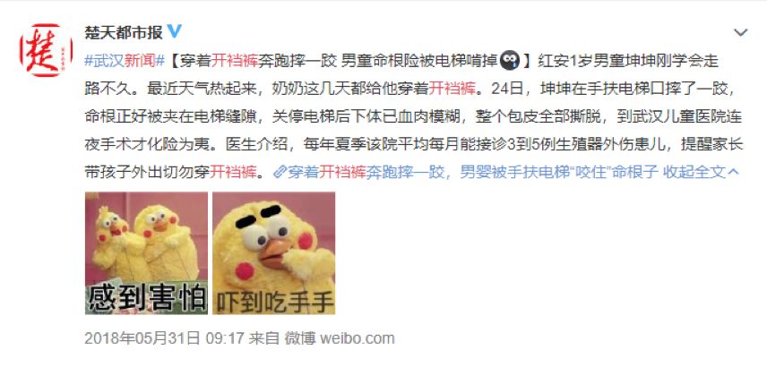                     男女宝私处护理差别大，这几件事一定要注意！