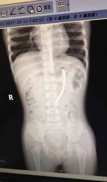                     玩具还是玩命？又一款危险玩具被列入黑名单！